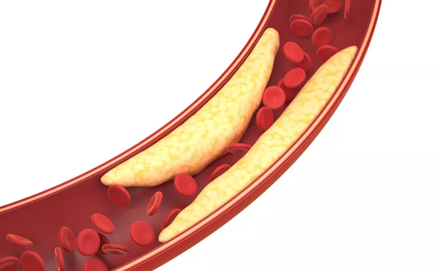 胆固醇对身体的作用以及会产生什么问题，不要被胆固醇吓怕