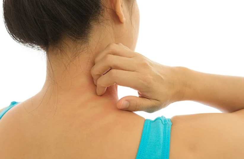 皮肤瘙痒，挠痒的痛快感过后更加瘙痒？用科学解释原因